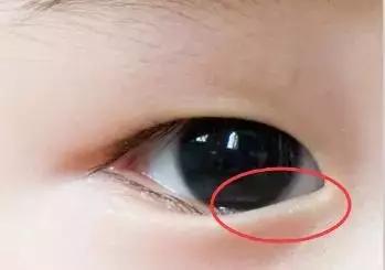 倒睫能自己好嗎？
