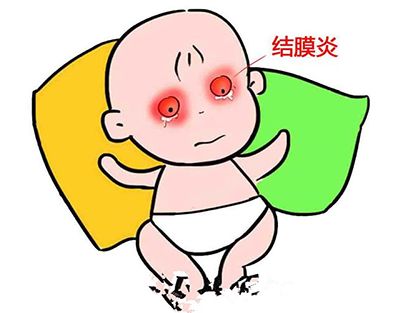 新生寶寶也會(huì)得結(jié)膜炎？ 新生兒結(jié)膜炎如何應(yīng)對(duì)？